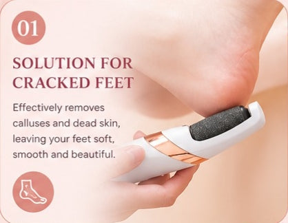 Foot Callus Remover Pedicure Tool for Smooth & Soft Feet