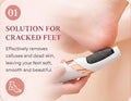 Foot Callus Remover Pedicure Tool for Smooth & Soft Feet