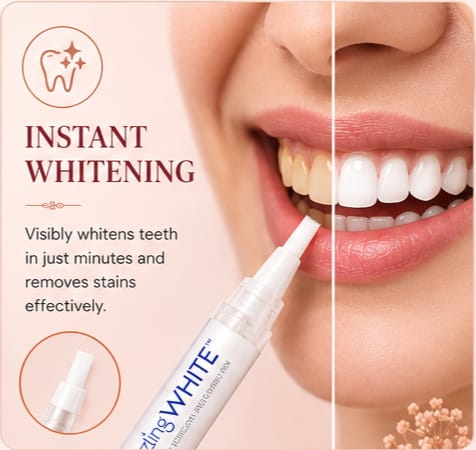 Teeth Whitening Pen – Instant Stain Removal & Bright Smile Whitening Gel Pen